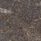 Immunohistochemical staining of human lymph node shows strong membranous positivity in non-germinal center cells.