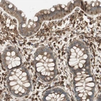 Immunohistochemical staining of human rectum shows strong membranous positivity in lymphoid cells.