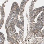 Immunohistochemical staining of human fallopian tube shows moderate membranous positivity in glandular cells.