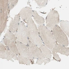 Immunohistochemical staining of human skeletal muscle shows very weak positivity in myocytes as expected.
