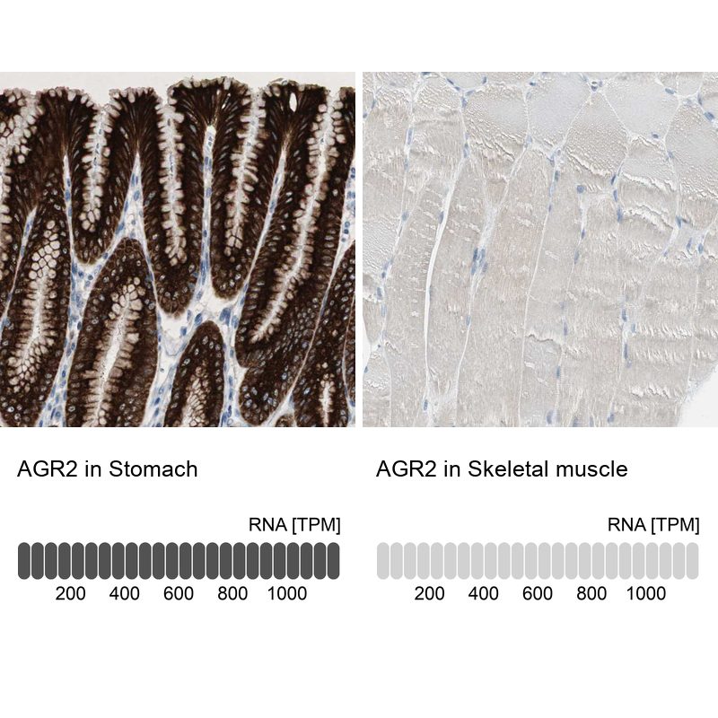 Anti-AGR2 Antibody