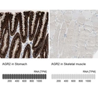 Anti-AGR2 Antibody