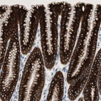Immunohistochemical staining of human stomach shows moderate to strong cytoplasmic positivity in glandular cells.