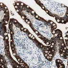 Immunohistochemical staining of human colon shows moderate to strong cytoplasmic positivity in glandular cells.