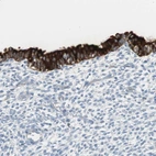 Immunohistochemical staining of human endometrium shows moderate to strong cytoplasmic positivity in glandular cells.