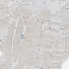 Immunohistochemical staining of human skeletal muscle shows no positivity in myocytes as expected.