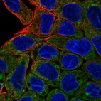Immunofluorescent staining of human cell line RT4 shows localization to cytosol.