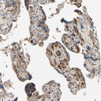 Anti-IL1RL1 Antibody