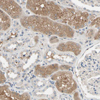 Immunohistochemical staining of human kidney shows weak to moderate cytoplasmic positivity in cells in tubules.