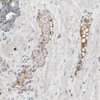 Anti-IL1RL1 Antibody