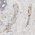 Immunohistochemical staining of human prostate shows weak to moderate cytoplasmic positivity in cells in tubules.