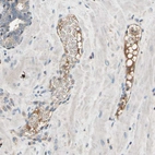 Immunohistochemical staining of human prostate shows weak to moderate cytoplasmic positivity in cells in tubules.