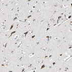 Immunohistochemical staining of human cerebral cortex shows moderate to strong cytoplasmic positivity in neurons.