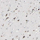 Immunohistochemical staining of human cerebral cortex shows moderate to strong cytoplasmic positivity in neurons.