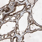 Immunohistochemical staining of human thyroid gland shows high expression.