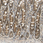 Immunohistochemical staining of human duodenum shows moderate cytoplasmic and nuclear positivity in glandular cells.