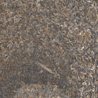 Immunohistochemical staining of human tonsil shows moderate cytoplasmic positivity in non-germinal center cells.