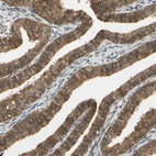 Immunohistochemical staining of human fallopian tube shows moderate cytoplasmic and nuclear positivity in glandular cells.