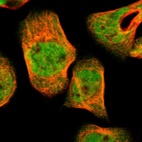 Immunofluorescent staining of human cell line A-431 shows localization to nucleoplasm & cytosol.