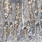 Immunohistochemical staining of human duodenum shows moderate cytoplasmic positivity in glandular cells.