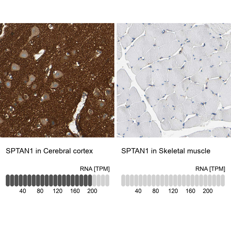 Anti-SPTAN1 Antibody