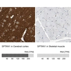 Anti-SPTAN1 Antibody