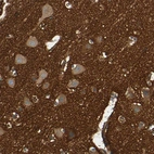 Immunohistochemical staining of human cerebral cortex shows strong positivity in neuropil.
