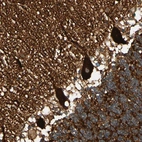 Immunohistochemical staining of human cerebellum shows strong cytoplasmic positivity in purkinje cells.