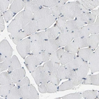 Immunohistochemical staining of human skeletal muscle shows no cytoplasmic positivity in myocytes as expected.