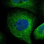 Immunofluorescent staining of human cell line A-431 shows localization to microtubules & vesicles.