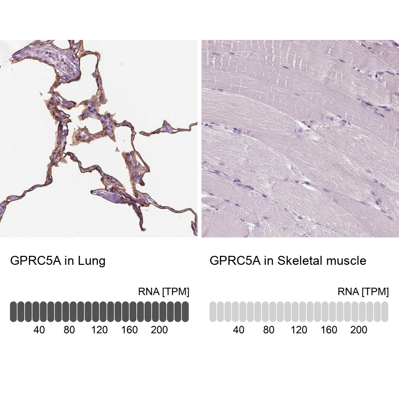 Anti-GPRC5A Antibody