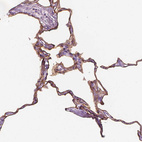 Immunohistochemical staining of human lung shows moderate membranous positivity in pneumocytes.