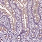 Immunohistochemical staining of human small intestine shows moderate positivity in apical membrane in glandular cells.