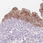 Immunohistochemical staining of human urinary bladder shows moderate membranous positivity in urothelial cells.