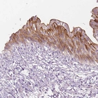 Immunohistochemical staining of human urinary bladder shows moderate membranous positivity in urothelial cells.