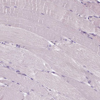 Immunohistochemical staining of human skeletal muscle shows no positivity in myocytes as expected.