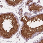 Immunohistochemical staining of human testis shows strong cytoplasmic positivity in cells in seminiferous ducts.
