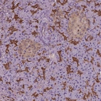 Immunohistochemical staining of human pancreas shows strong cytoplasmic positivity in exocrine glandular cells.