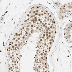 Immunohistochemical staining of human testis shows strong nuclear positivity in cells in seminiferous ducts.