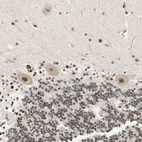 Immunohistochemical staining of human cerebellum shows moderate nuclear positivity in Purkinje cells.