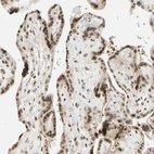 Immunohistochemical staining of human placenta shows moderate to strong nuclear positivity in trophoblastic cells.