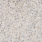 Immunohistochemical staining of human liver shows very weak positivity in hepatocytes as expected.