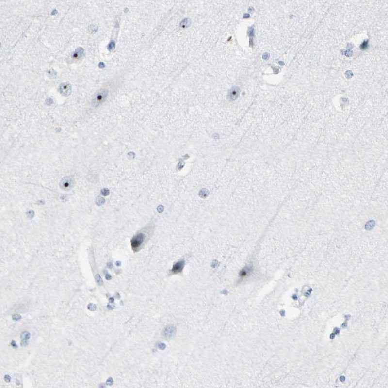 Anti-ZSCAN1 Antibody