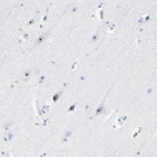 Anti-ZSCAN1 Antibody