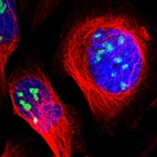 Immunofluorescent staining of human cell line U-2 OS shows localization to nucleoli.