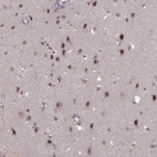 Immunohistochemical staining of human cerebral cortex shows strong nuclear positivity in neuronal cells.