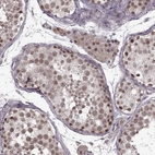 Immunohistochemical staining of human testis shows moderate nuclear positivity in cells in seminiferous ducts.