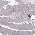 Immunohistochemical staining of human skeletal muscle shows no positivity in myocytes as expected.