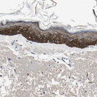 Anti-MANSC1 Antibody
