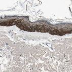Anti-MANSC1 Antibody